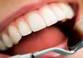 Лечение зубов в клинике Сураски-Ихилов